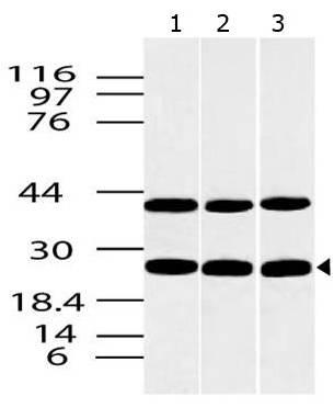 Polyclonal Antibody to CLEC4E