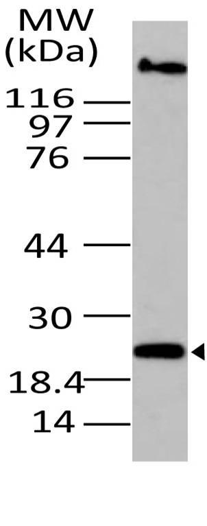 Polyclonal Antibody to CLEC8A