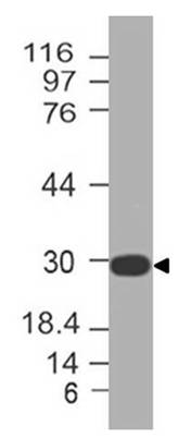 Polyclonal Antibody to SOCS3