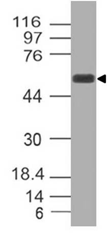 Polyclonal Antibody to TOX