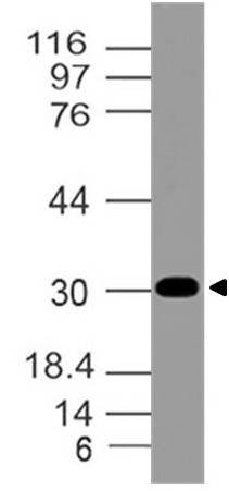 Polyclonal Antibody to AIMP2