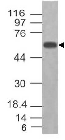 Polyclonal Antibody to ROR alpha