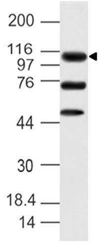 Polyclonal Antibody to HOIP/RNF31