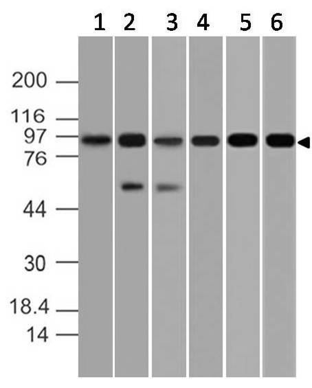 Polyclonal antibody to NIK