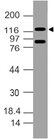 Polyclonal Antibody to DDB1