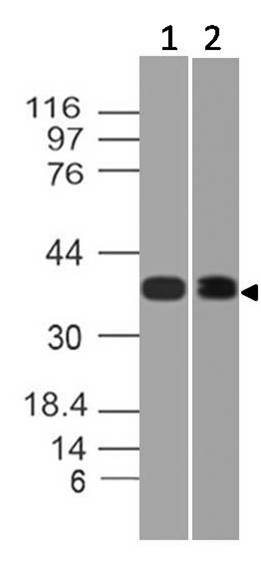 Polyclonal Antibody to HDAC11