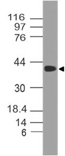 Polyclonal Antibody to SETD7