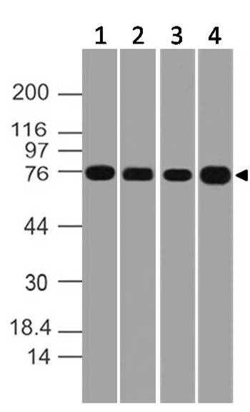 Polyclonal antibody to MTA2