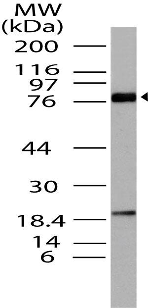 Polyclonal Antibody to BRD4, HUNK1