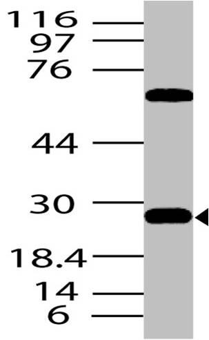 Polyclonal Antibody to DKK1