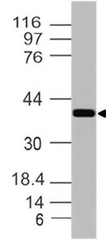 Polyclonal Antibody to EpCAM-cyt