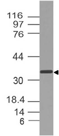 Polyclonal Antibody to SPARC/Osteonectin