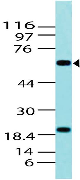 Polyclonal Antibody to p63