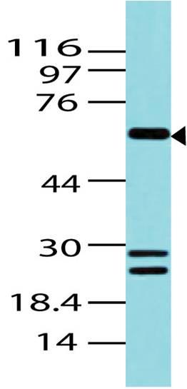 Polyclonal Antibody to BCL6