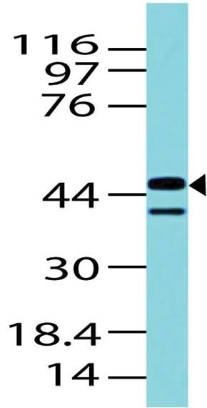 Polyclonal Antibody to IDH1