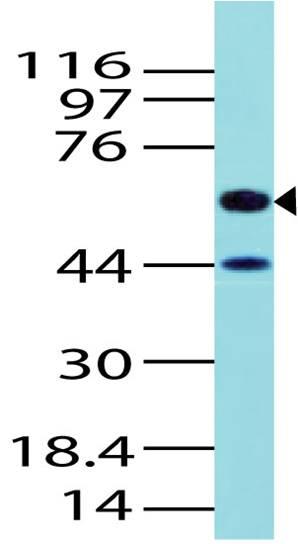 Polyclonal Antibody to ALK1