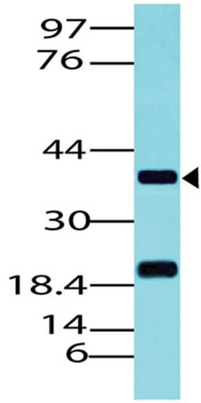 Polyclonal Antibody to PAX5