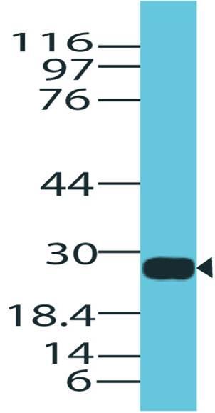 Polyclonal Antibody to Granzyme B