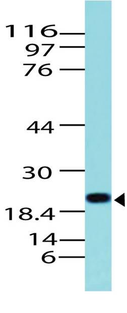 Polyclonal Antibody to CD3e