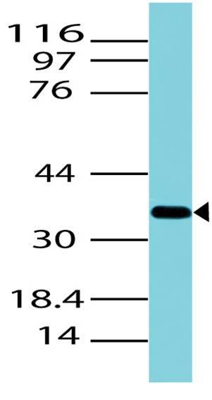 Polyclonal Antibody to Arginase