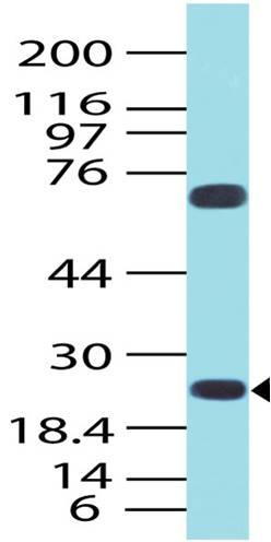 Polyclonal Antibody to HGAL