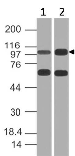 Polyclonal Antibody to CD10