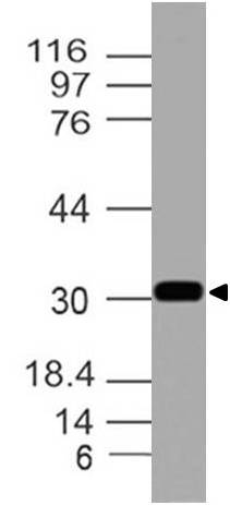 Polyclonal Antibody to Calretinin