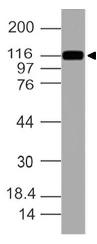 Polyclonal Antibody to Cadherin-17