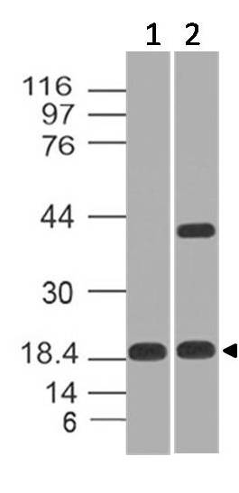 Polyclonal Antibody to CELA3B