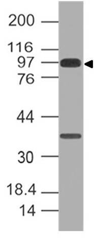 Polyclonal Antibody to E Cadherin