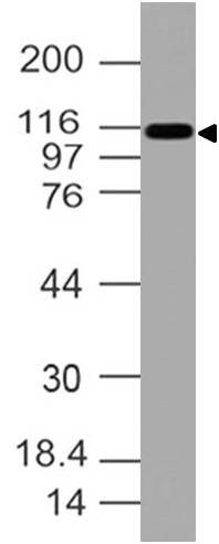 Polyclonal Antibody to CD11C