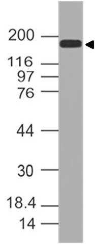 Polyclonal Antibody to Topo II alpha