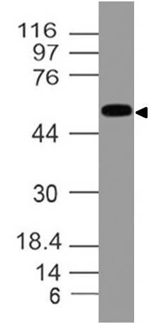 Polyclonal Antibody to ALDH1A1