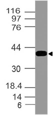 Polyclonal Antibody to INI-1/SNF5