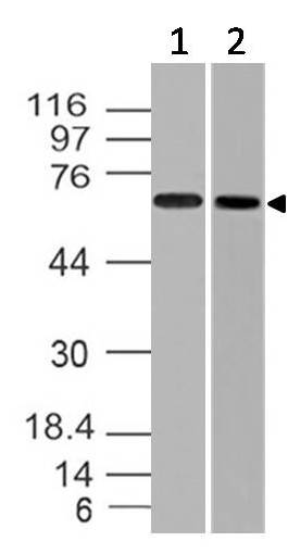 Polyclonal Antibody to Endoglin