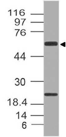 Polyclonal Antibody to Antichymotrypsin