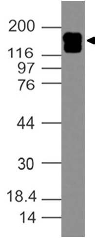 Polyclonal Antibody to HER2