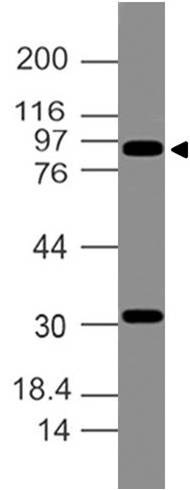 Polyclonal Antibody to Villin1