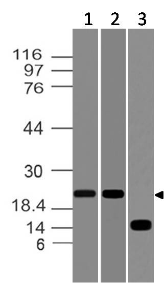 Polyclonal Antibody to  Ferritin heavy chain