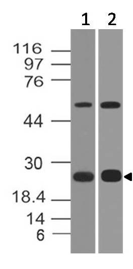 Polyclonal Antibody to  B7-H4 mouse