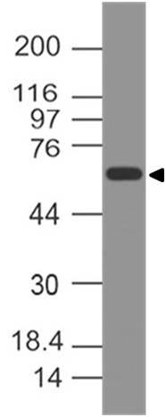 Polyclonal Antibody to  CD141