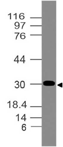 Polyclonal Antibody to  NKx2.2