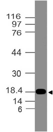 Polyclonal Antibody to  Filaggrin-1