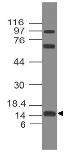 Polyclonal Antibody to  FABP5