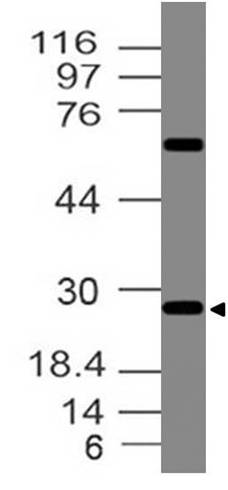 Polyclonal Antibody to  Erythropoietin