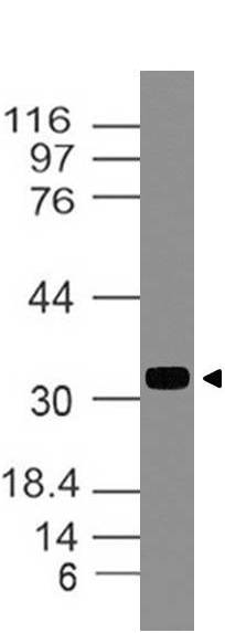 Polyclonal Antibody to  TIMP1