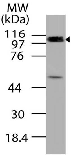 Polyclonal Antibody to CYLD