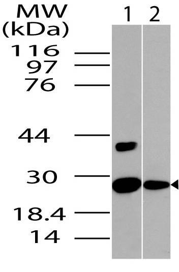 Polyclonal Antibody to NQO1