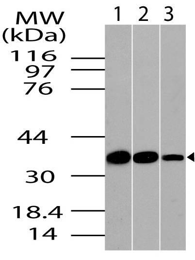 Polyclonal Antibody to CLIM1/PDLIM1