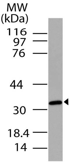 Polyclonal Antibody to C5L2/GPCR77